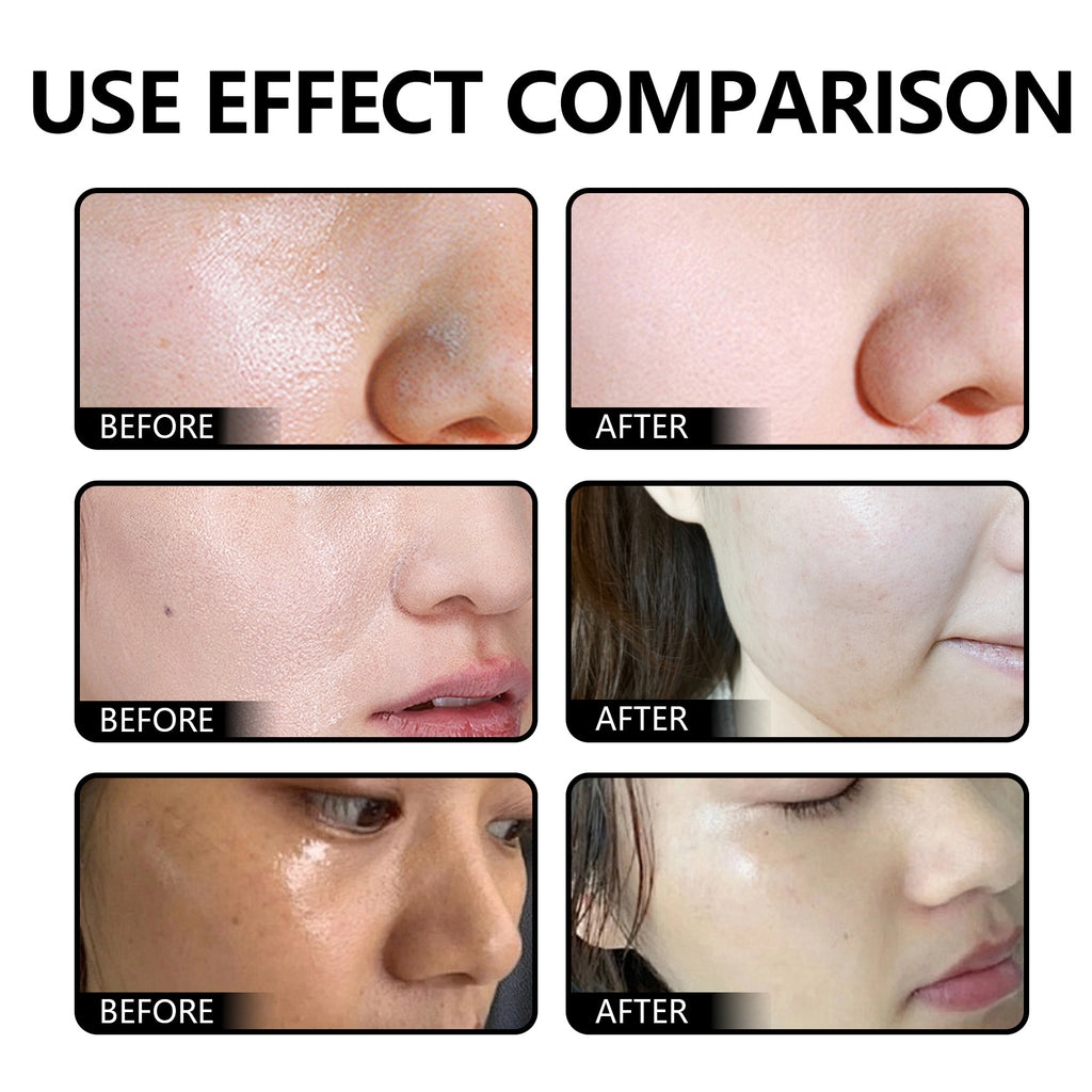 Hydrating Moisturizing Facial Cleanser – Gentle Care